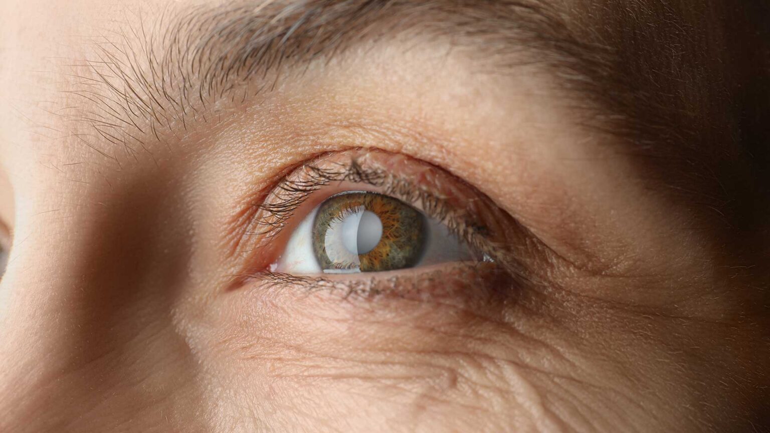 can-you-drink-alcohol-after-cataract-surgery-in-the-uk