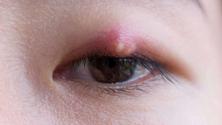 blog-image-stye-2