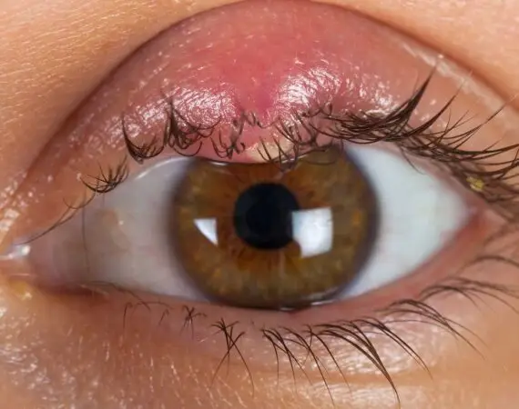 blog-image-stye