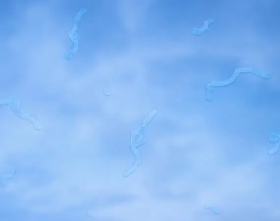 blog-image-floaters-4