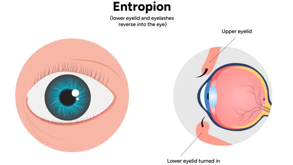 blog-image-entropion-1