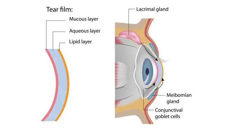 blog-image-meibomian-gland-dysfunction-2