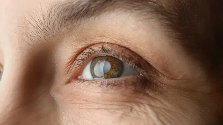 blog-image-cataract-10