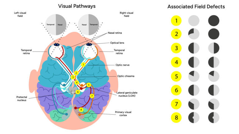 blog-image-visual-pathways