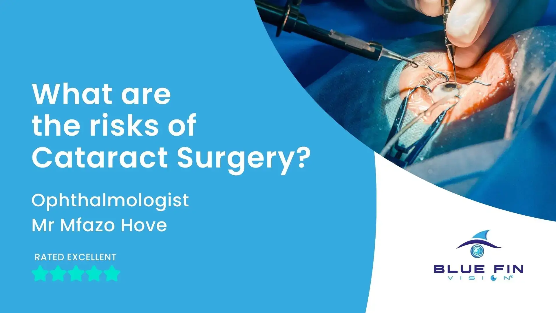 Risks of Cataract Surgery | What to Expect