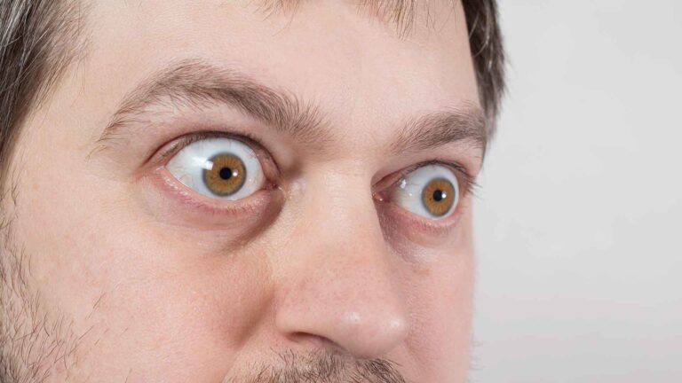blog-image-graves-disease-2