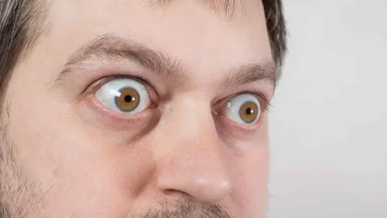blog-image-graves-disease-2