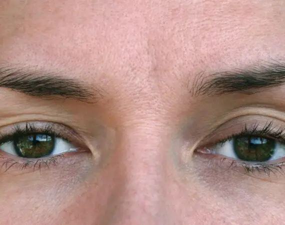 blog-image-ptosis-3