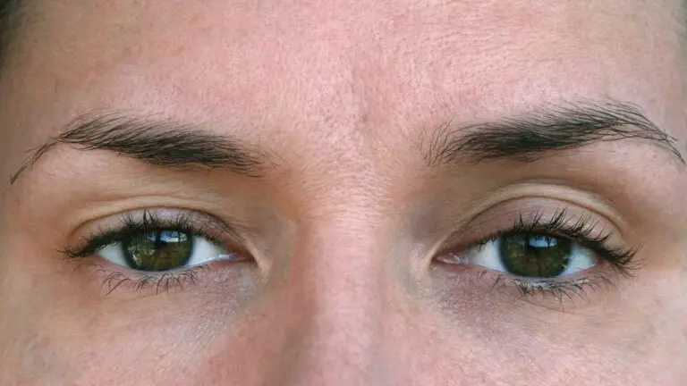 blog-image-ptosis-3