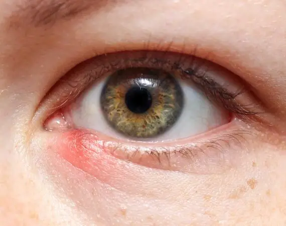 blog-image-stye-3
