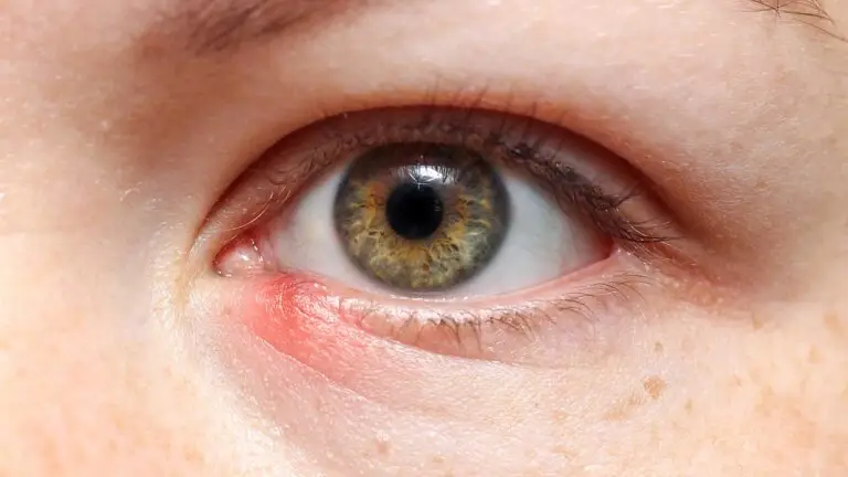 blog-image-stye-3