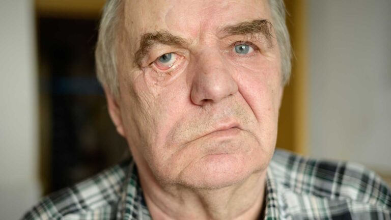 blog-image-facial-palsy