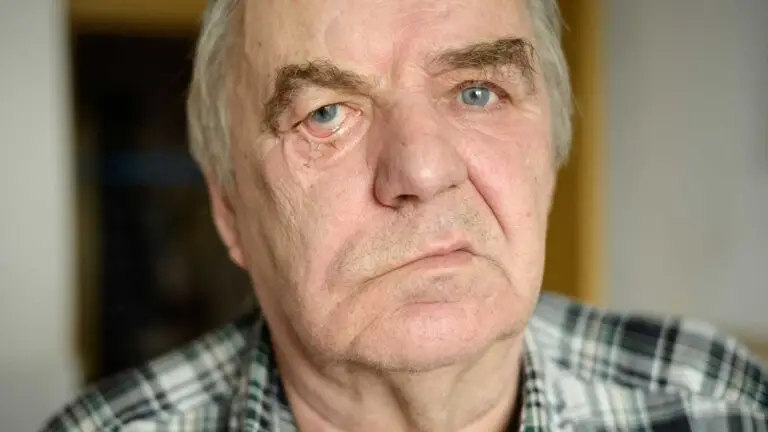 blog-image-facial-palsy