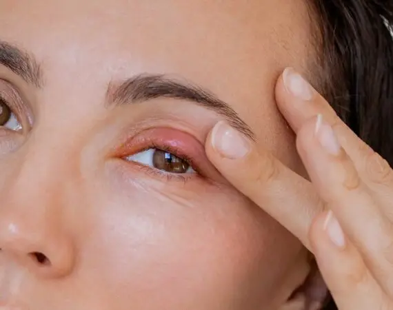 blog-image-orbital-cellulitis-2