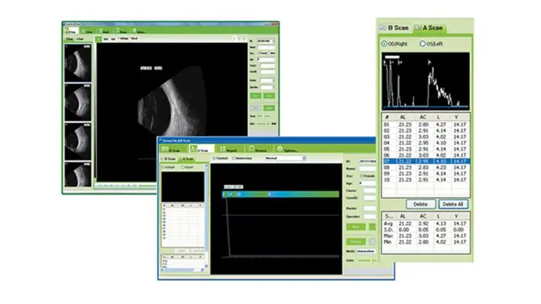 blog-image-A-B-scan-1