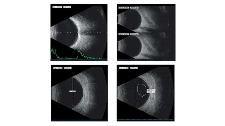 blog-image-A-B-scan-3