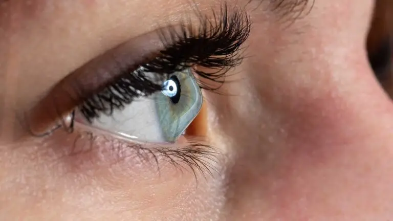 blog-image-keratoconus-7