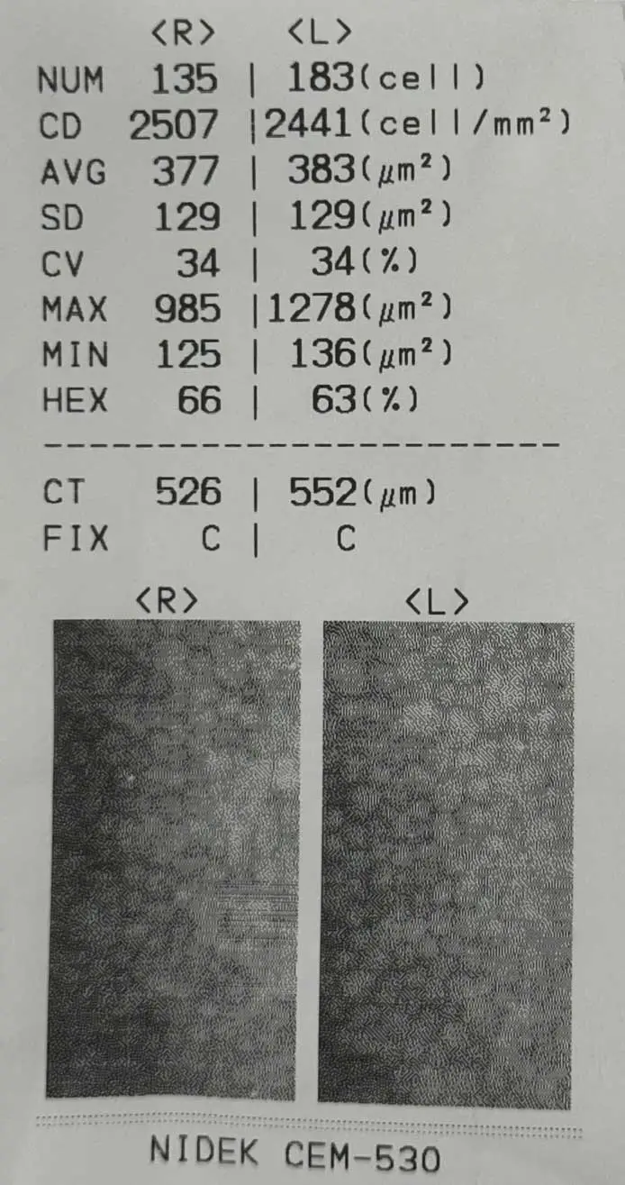 specular-microscopy-3
