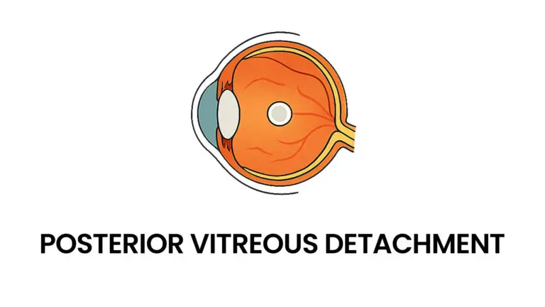 blog-image-posterior-vitreous-detachment